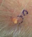 Scalp - Before Treatment