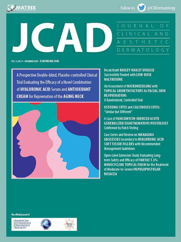 JCAD cover