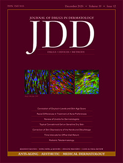 JDD cover